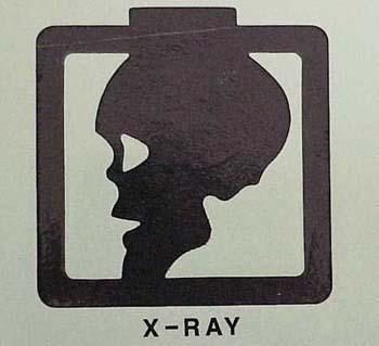 xray.jpg